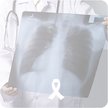 Cirurgia Oncol�gica Tor�cica