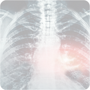 Cirurgia Tor�cica